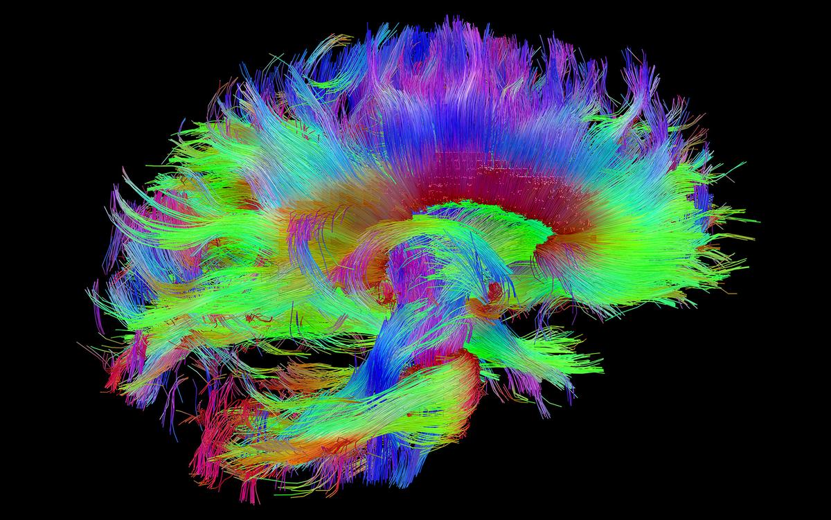 Mapping the brain’s connective structure could unlock immortality | Aeon Essays