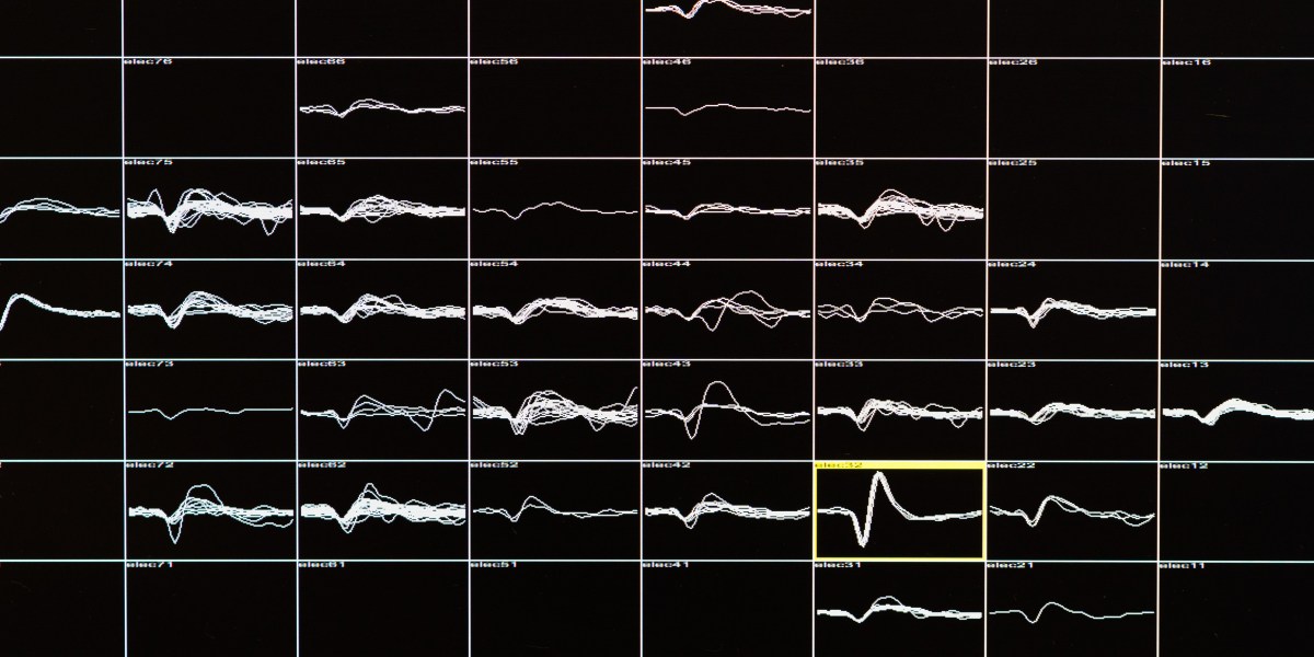 A new implant for blind people jacks directly into the brain