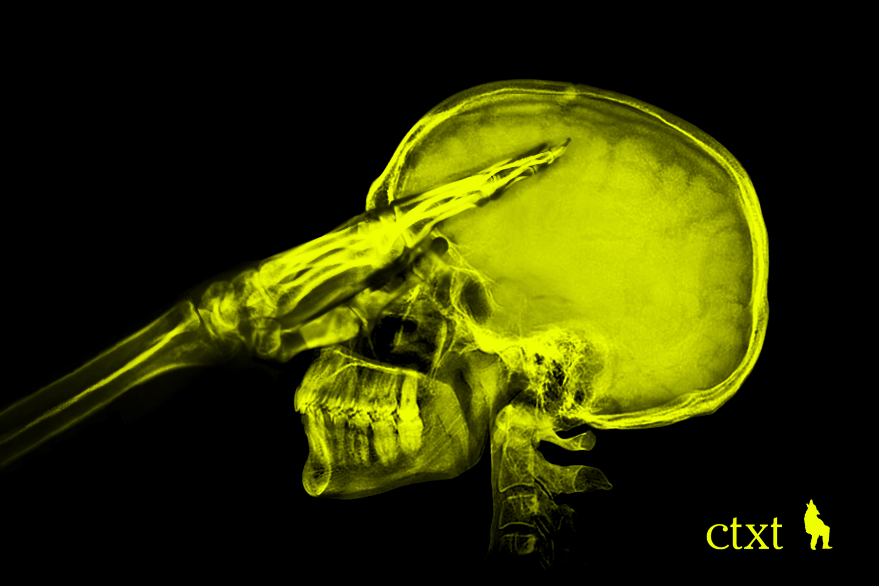 Derechas radicales y autoritarismo reaccionario