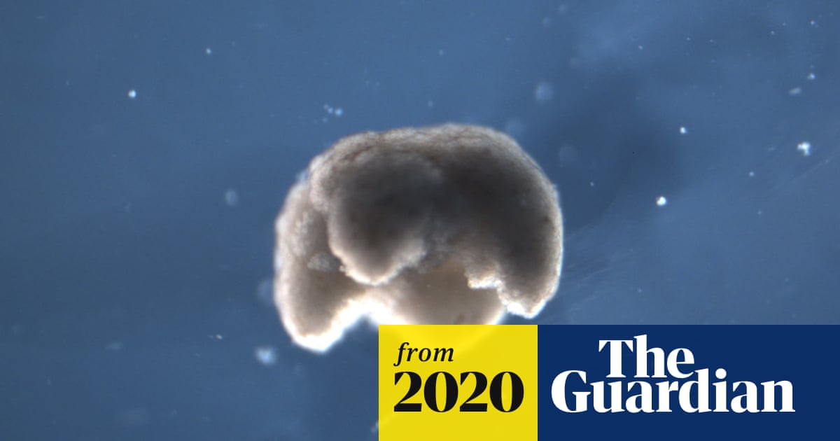 Scientists use stem cells from frogs to build first living robots